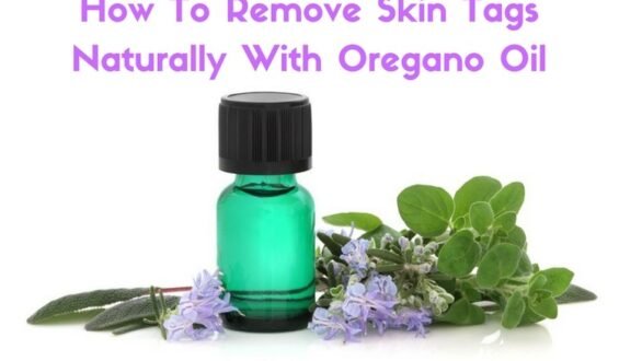 Oregano | a powerful oil that can remove skin tags & other unsightly blemishes